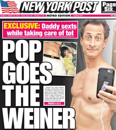 Anthony Weiner NY Post