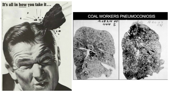 Man beong hit with lump of coal and black lung 